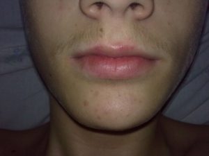 Почему не растет борода?