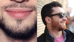 Как выпрямить бороду
