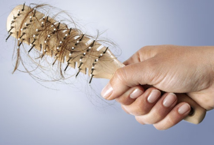 Выпадение волос при алопеции