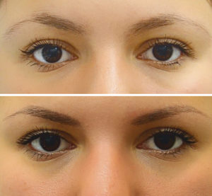 Техника карандаша